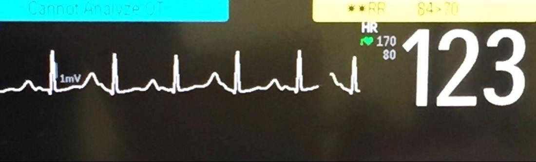 23632510_295333314287645_3751631982099443638_o